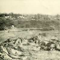 Casualties of the Battle of Corinth in Mississippi during the Civil War
